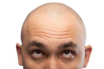 Bald head shaver
